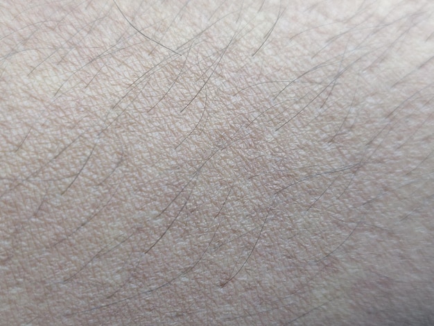 A close up of a human skin with a light brown spot on the skin.