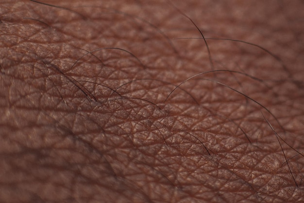 Close-up of human skin