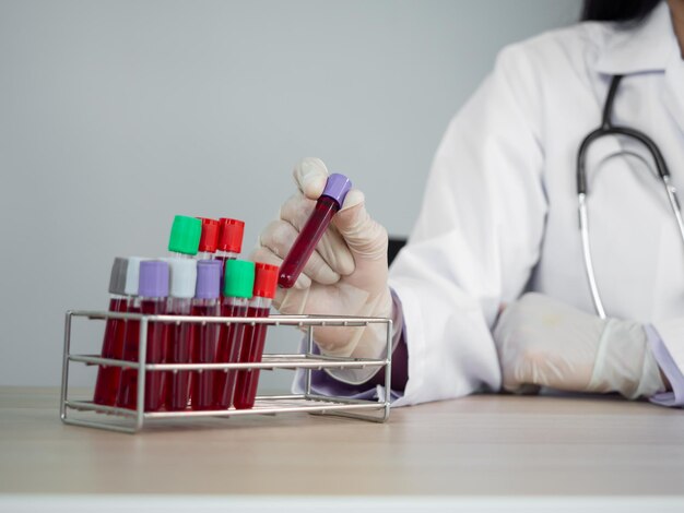 Photo close-up of laboratorys hand holding blood test tube on the table