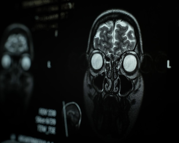 Крупный план магнитно-резонансной томографии человеческого мозга.