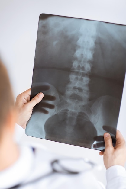 close up of male doctor holding x-ray or roentgen image