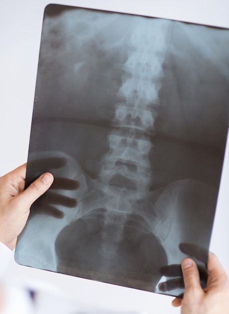 close up of male doctor holding x-ray or roentgen image