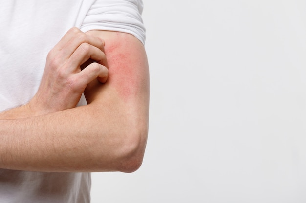 close up of male scratching the itch on his hand, isolated on grey background