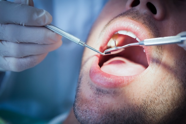 Foto chiuda in su dell'uomo che ha esaminato i suoi denti