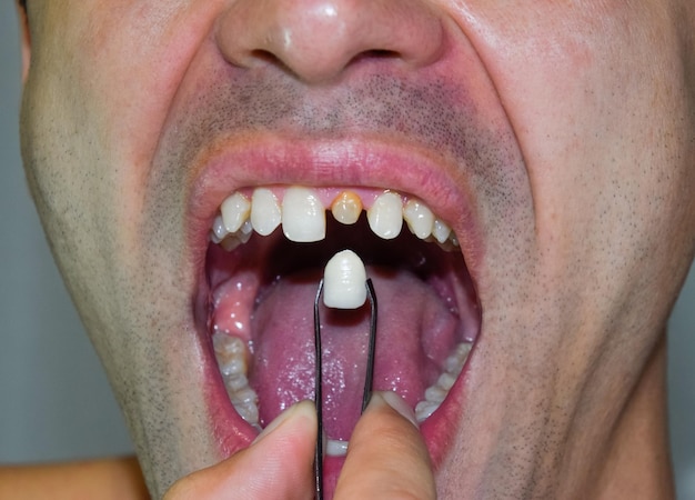 Photo close-up of man holding teeth