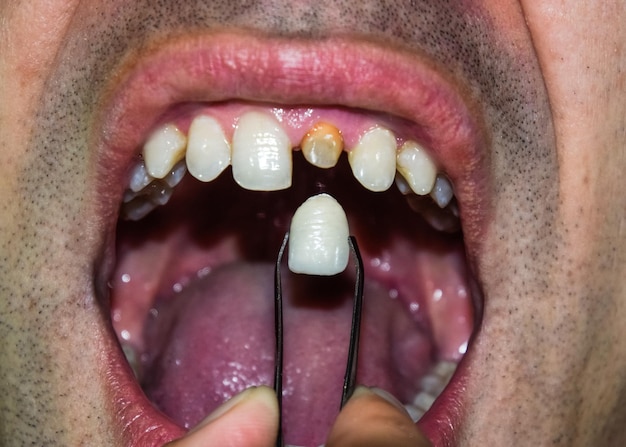 Photo close-up of man holding teeth