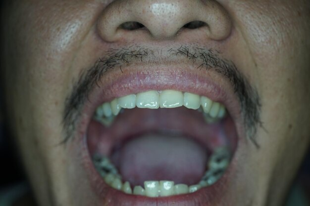 Photo close-up of man with mouth open