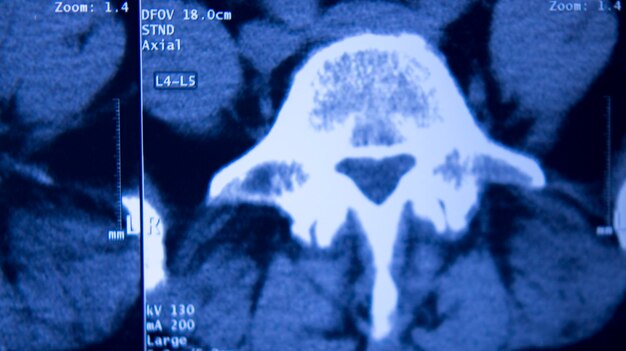 Foto prossimo piano di una radiografia medica