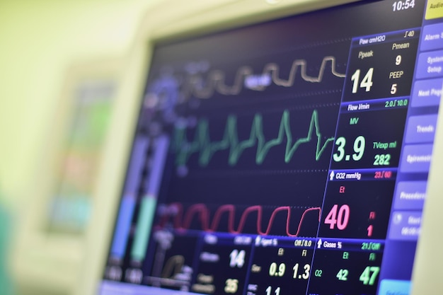 Photo close-up of monitoring equipment at hospital