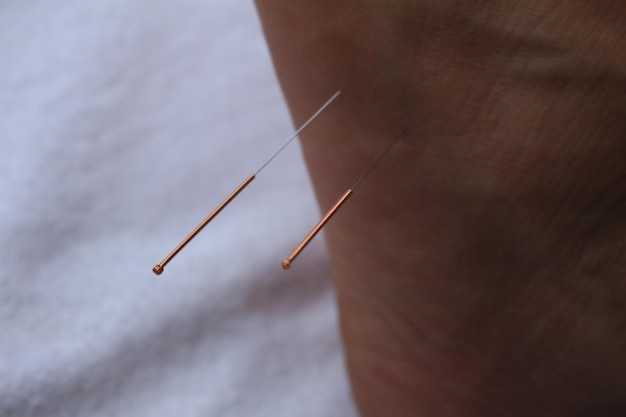 close-up of needle on hand