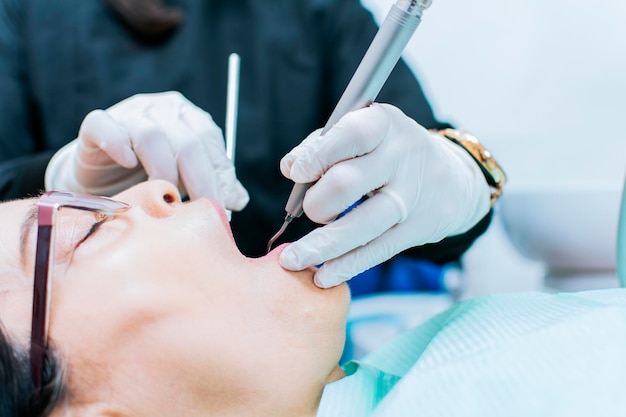 Primo piano o paziente controllato dal dentista dentista che esegue il trattamento del canale radicolare sul dentista paziente che esegue il controllo dentale