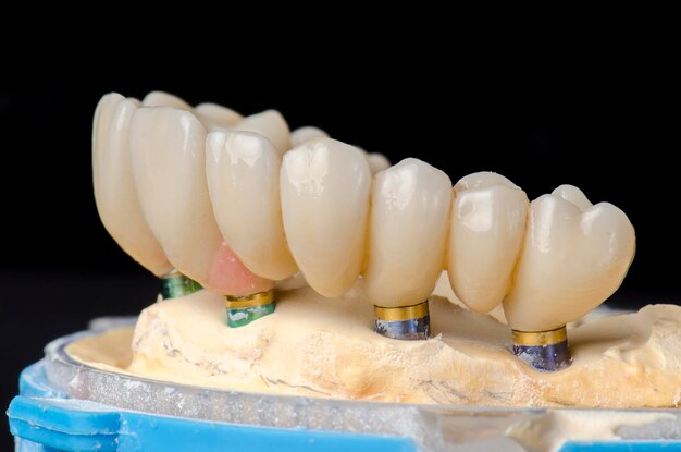 사진 검은색 배경 에 대한 치아 의 클로즈업