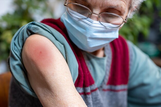 Фото Близкий план опухшей руки пожилой женщины