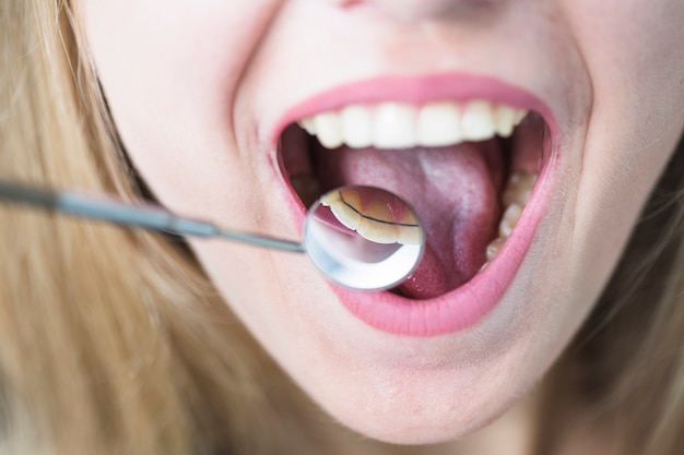 Фото Крупный план открытый рот женщины с зубным зеркалом