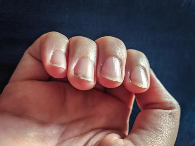 Foto close-up della mano della persona che tiene l'anello su uno sfondo nero