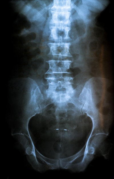 A close up of a person's hip showing the lower left hip.