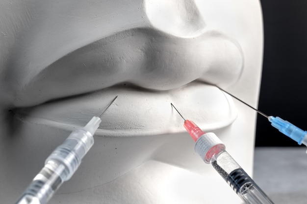 보톡스 주입을 위한 회반죽 흰색 여성 입술과 의료용 주사기를 닫습니다 창의적인 입술 주입 개념
