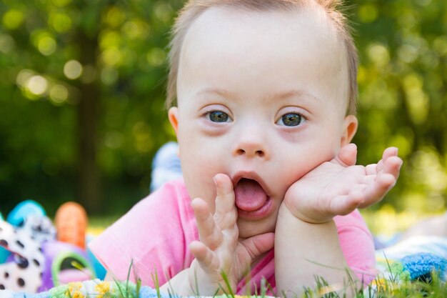 Photo close-up portrait of cute baby with down syndrome