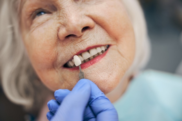 Close up portrait of dentist checking and selecting color of the teeth while making the process of treatment in the professional clinic