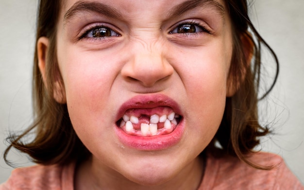 Photo close-up portrait of girl showing her gap toothed