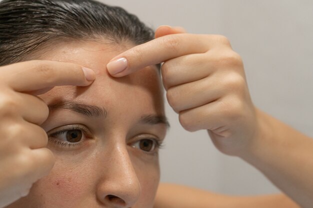 Close-up portrait of a girl squeezes out a pimple on her forehead. An awkward moment before a date.