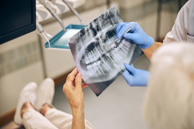 Close up portrait of photo of teeth client while having conversation with orthodontist doctor in dental clinic