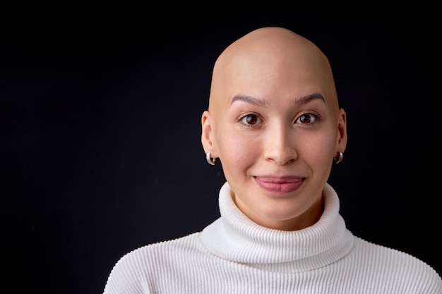 Close-up portrait of positive smiling bald female in casual wear posing looking at camera. Attractive lady with allopecia or cancer enjoy life, having good mood, no reason to feel bad. copy space