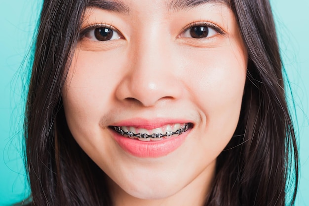 Close-up portrait of a smiling young woman