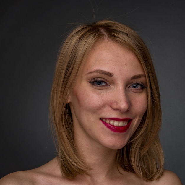 Close-up portrait of a young woman with acne skin problem on her face. - image