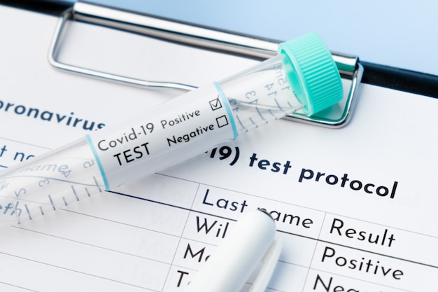 사진 양성 covid-19 테스트 튜브와 의료 테스트 프로토콜을 닫습니다.