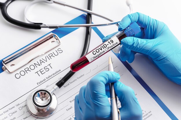 Close up of Scientist hand with a blood sample of COVID-19