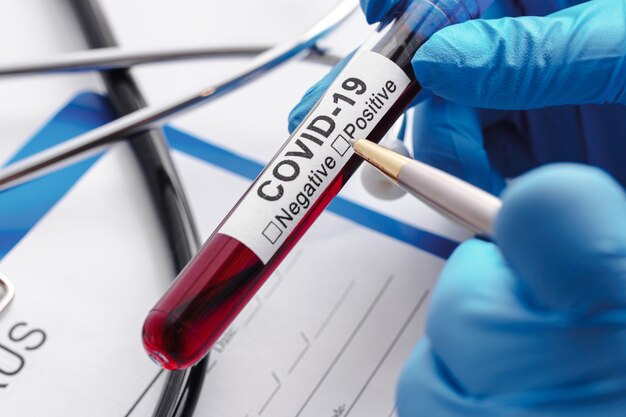 Photo close up of scientist hand with a blood sample of covid-19