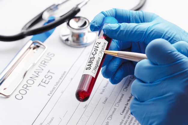 Close up  of Scientist hand with a blood sample of SARS-CoV-2