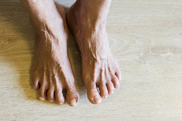 Photo close-up of senior woman legs on floor