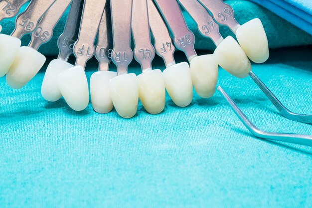 Закройте руководство по оттенку для проверки цвета зубной коронки в клинике.