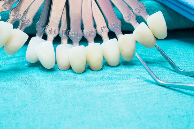 Close up shade guide for check color of tooth crown in clinic