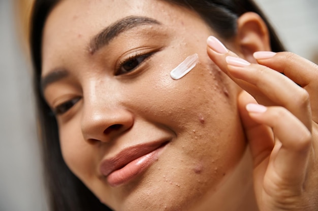 close up shot of young asian woman with brunette hair applying acne treatment cream on face