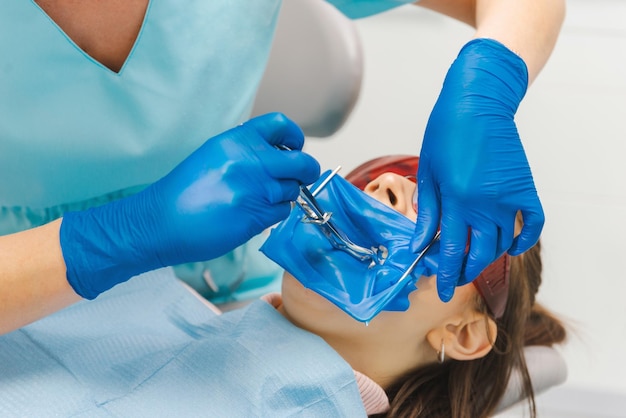 Immagine ravvicinata di una giovane donna con la bocca aperta dal dentista in guanti