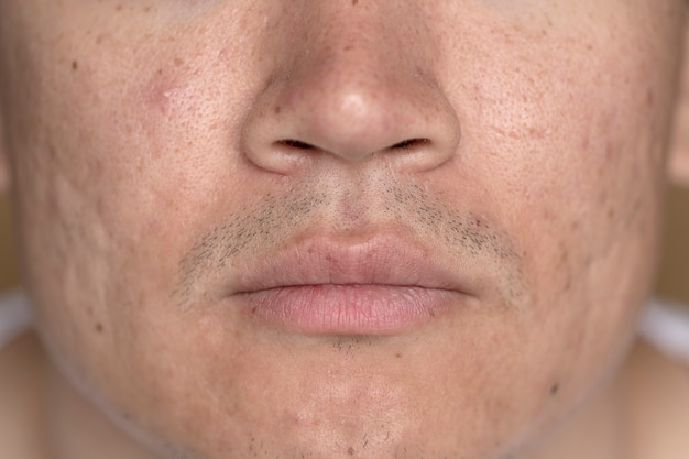 Photo close up on skin pores during face care routine