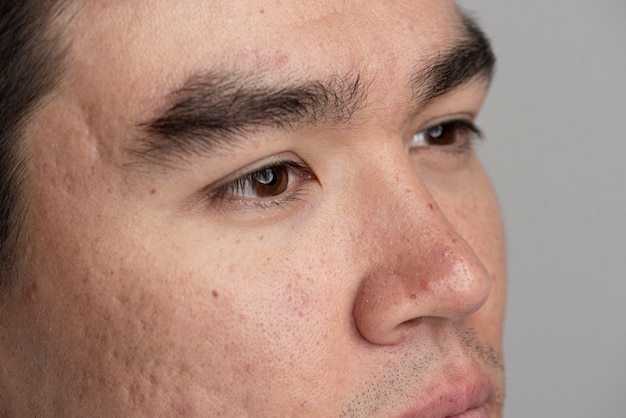 Foto primo piano sui pori della pelle durante la routine di cura del viso
