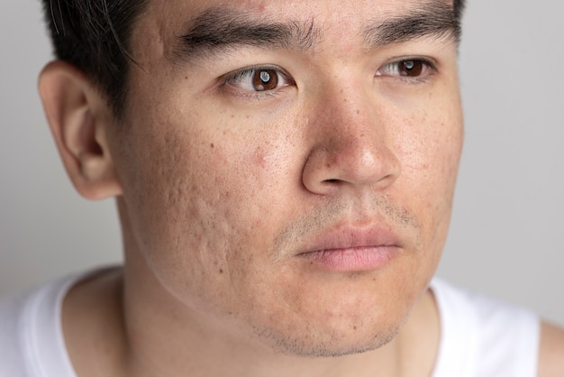 close up on skin pores during face care routine