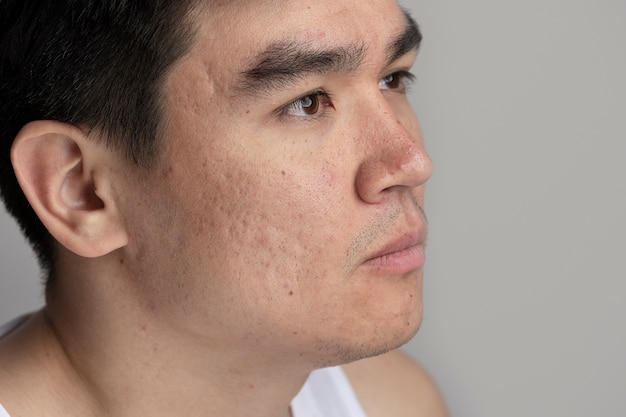 close up on skin pores during face care routine