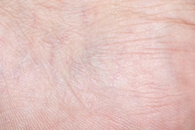 Close-up skin