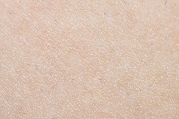 Close-up skin