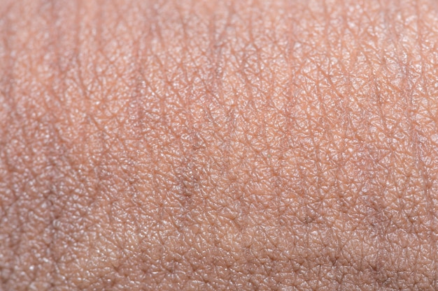 Close-up skin