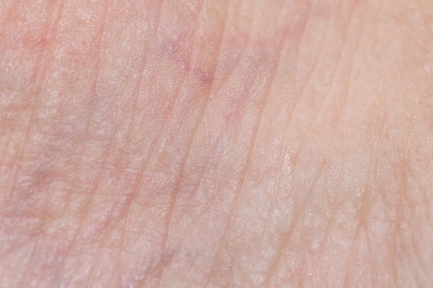 Close-up skin