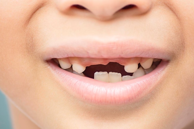 Photo close-up of smiling boy