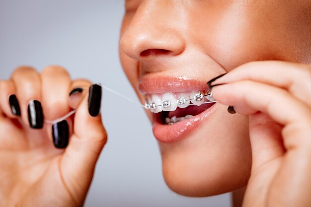 Close-up of a smiling girl face with braces flossing her teeth.