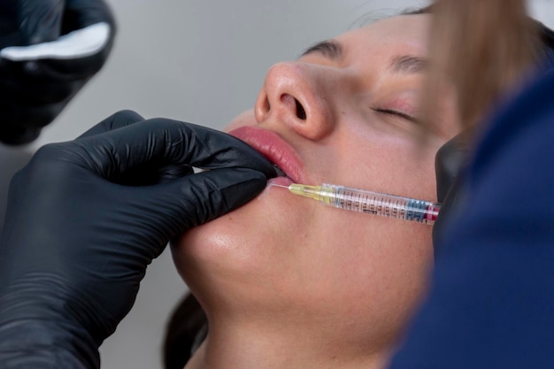 若い女性の唇にヒアルロン酸を注射する注射器のクローズアップ