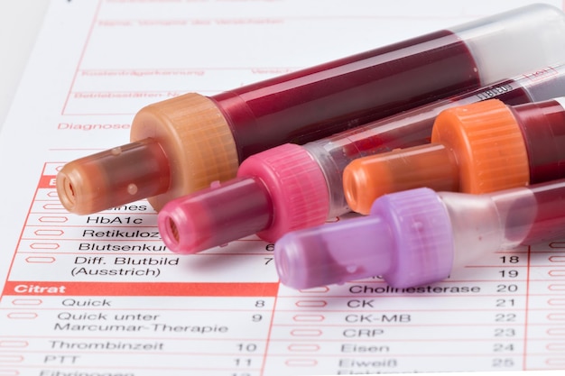 Photo close-up of syringe with medical records